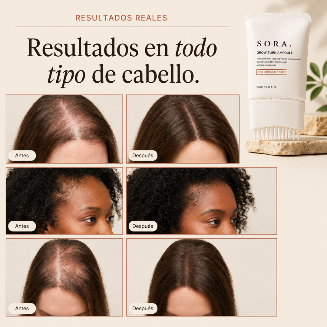SORA. Sérum Capilar Coreano Anticaída